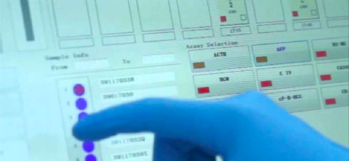 Maglumi 800: La plataforma de inmunoensayos que revoluciona la rutina del laboratorio